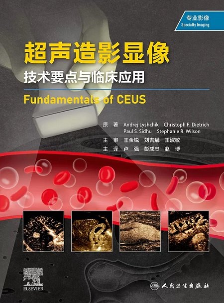 超声造影显像 技术要点与临床应用 卢强 彭成忠 赵博 人民卫生出版社